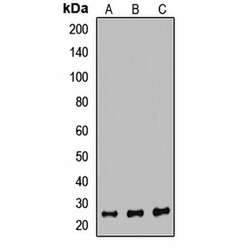 PSMB6 Rabbit Polyclonal Antibody