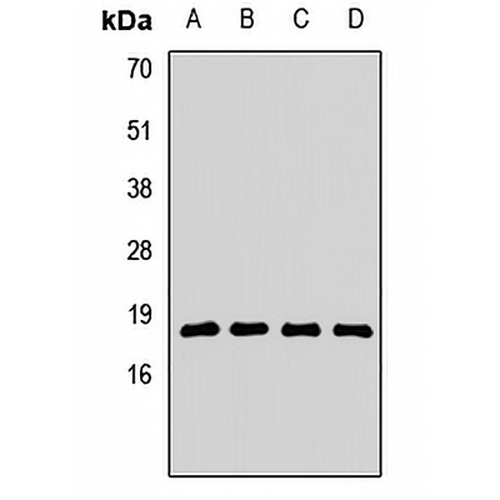 RPL23A Rabbit Polyclonal Antibody