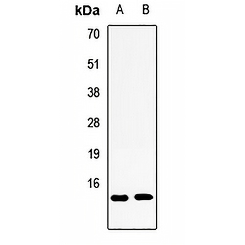 S100-A3 Rabbit Polyclonal Antibody