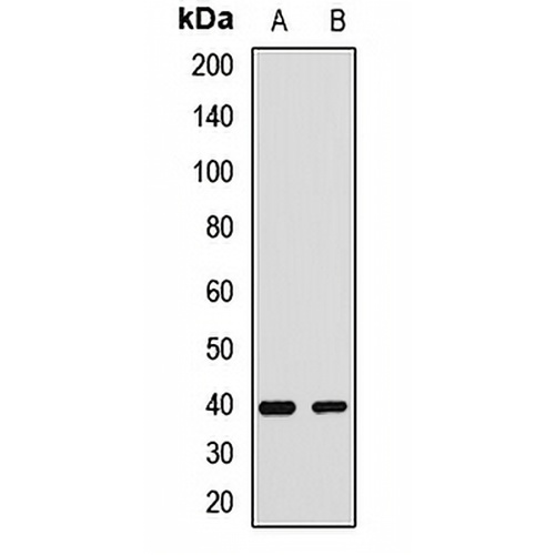 SH3GL3 Rabbit Polyclonal Antibody