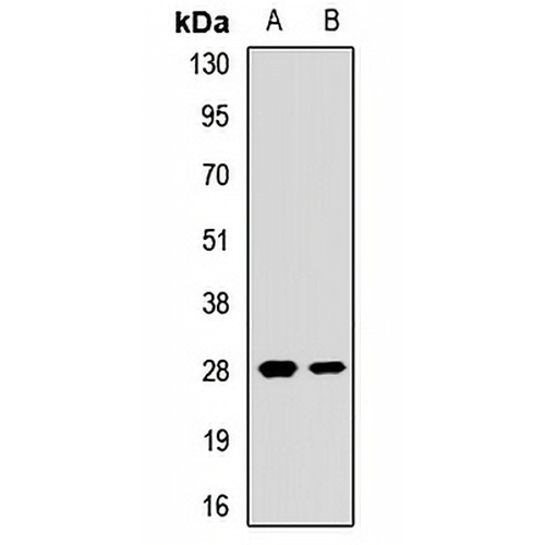 EIF4E2 Rabbit Polyclonal Antibody