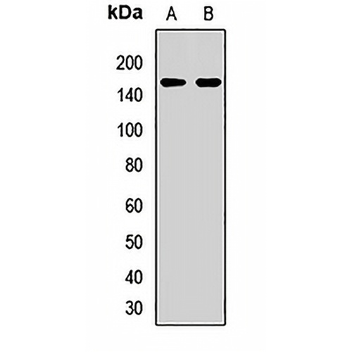 SAF-B2 Rabbit Polyclonal Antibody