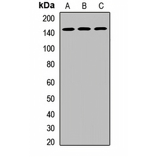 DHX38 Rabbit Polyclonal Antibody