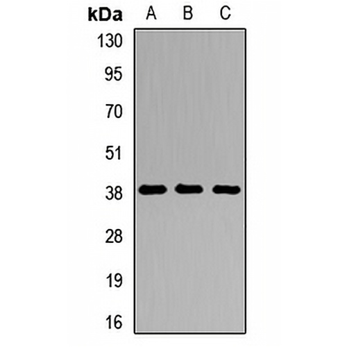 DMC1 Rabbit Polyclonal Antibody