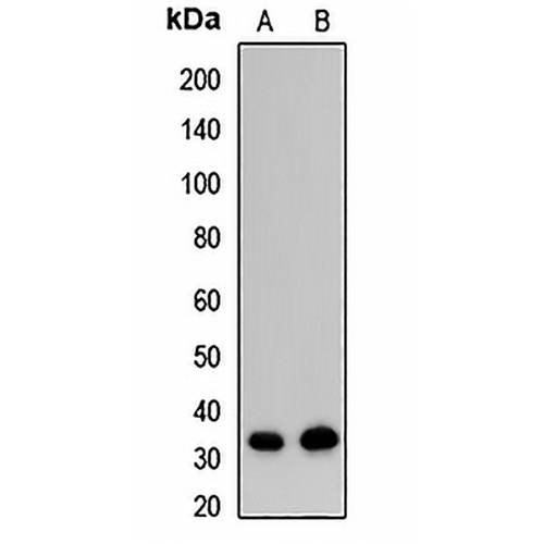 EXOSC8 Rabbit Polyclonal Antibody