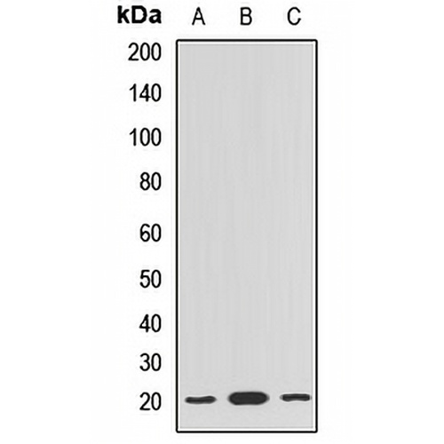 BLOC1S6 Rabbit Polyclonal Antibody
