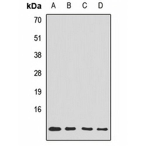 Tim10 Rabbit Polyclonal Antibody
