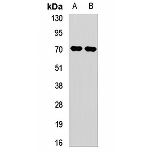 CROT Rabbit Polyclonal Antibody
