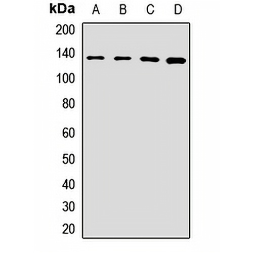 CC2D1A Rabbit Polyclonal Antibody