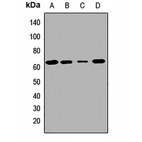 MKS1 Rabbit Polyclonal Antibody