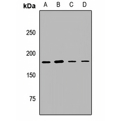 UGGT1 Rabbit Polyclonal Antibody