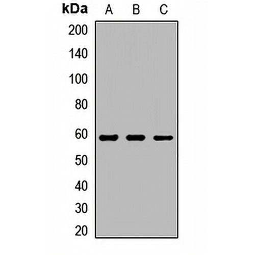 LPCAT1 Rabbit Polyclonal Antibody