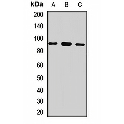 LARP4 Rabbit Polyclonal Antibody