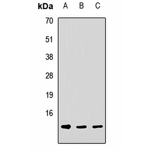 DNAJC19 Rabbit Polyclonal Antibody