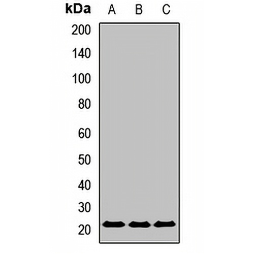 UBE2F Rabbit Polyclonal Antibody