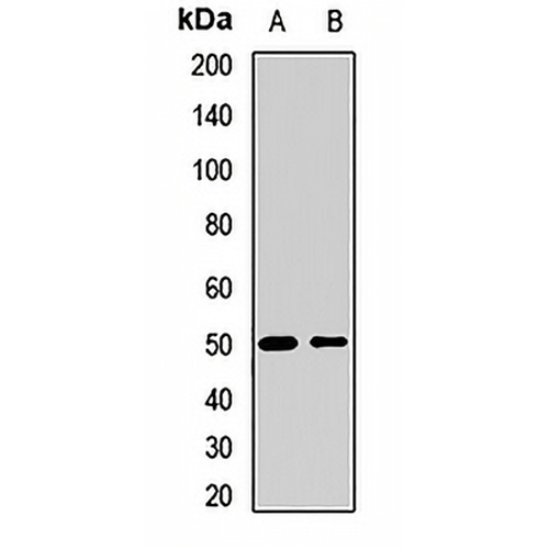 SESN3 Rabbit Polyclonal Antibody