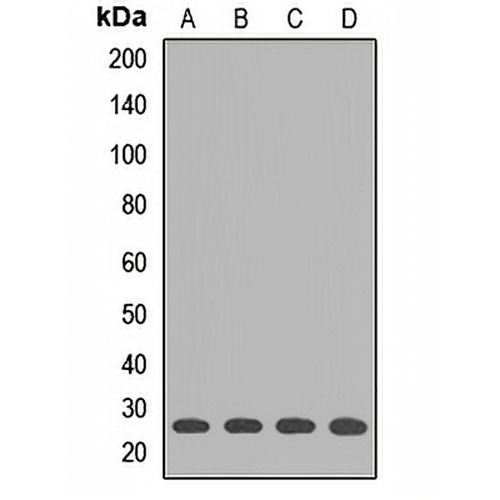 GSTK1 Rabbit Polyclonal Antibody