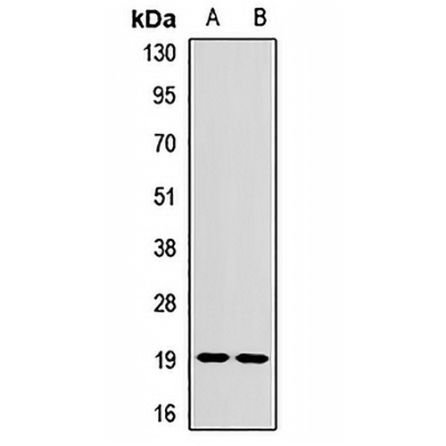 CD42a Rabbit Polyclonal Antibody