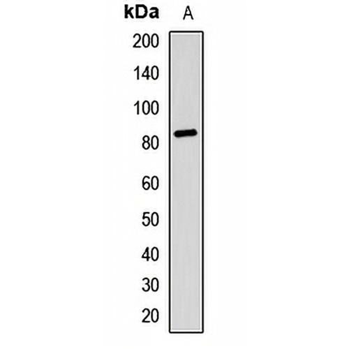 RSK2 Rabbit Polyclonal Antibody