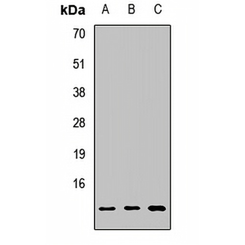 MGP Rabbit Polyclonal Antibody