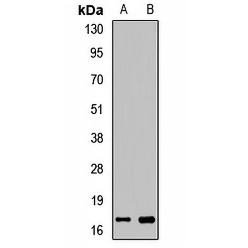 Myoglobin Rabbit Polyclonal Antibody