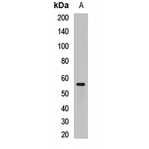 CBX4 Rabbit Polyclonal Antibody
