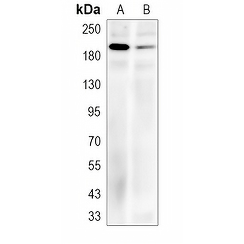 AREB6 Rabbit Polyclonal Antibody