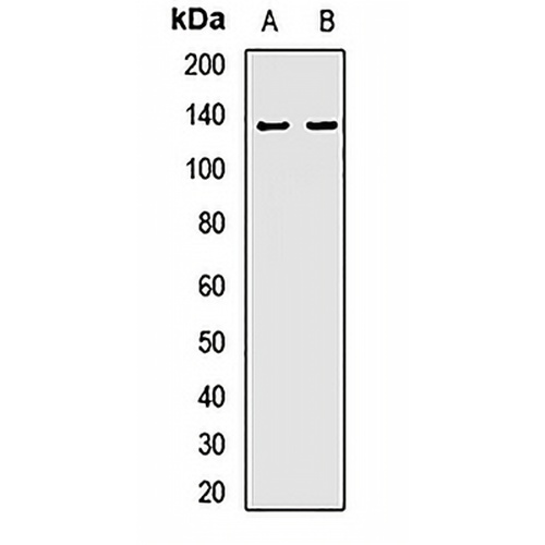ECE1 Rabbit Polyclonal Antibody