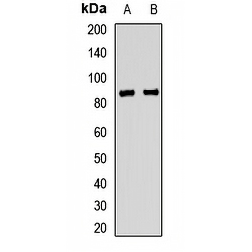 ERCC2 Rabbit Polyclonal Antibody