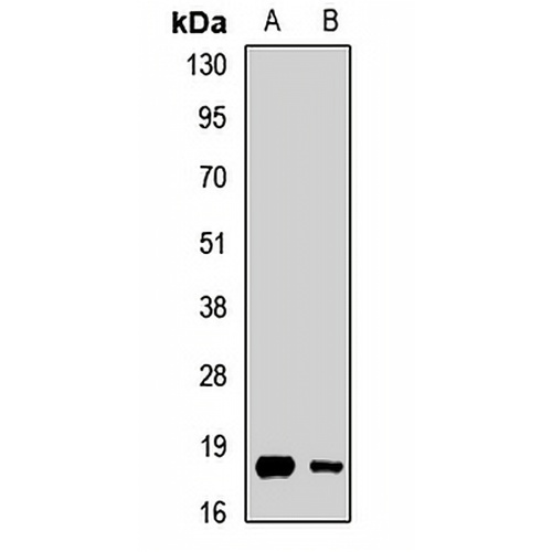 Leptin Rabbit Polyclonal Antibody