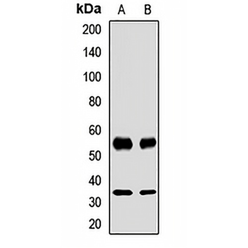 ATP1B1 Rabbit Polyclonal Antibody