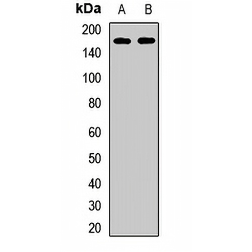 Kinectin 1 Rabbit Polyclonal Antibody