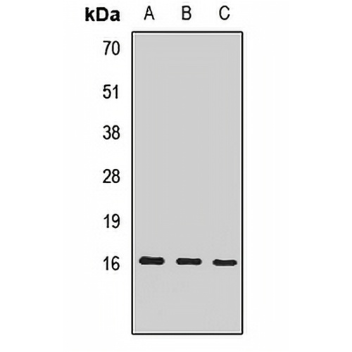EIF1AX Rabbit Polyclonal Antibody