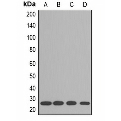 RPL10A Rabbit Polyclonal Antibody