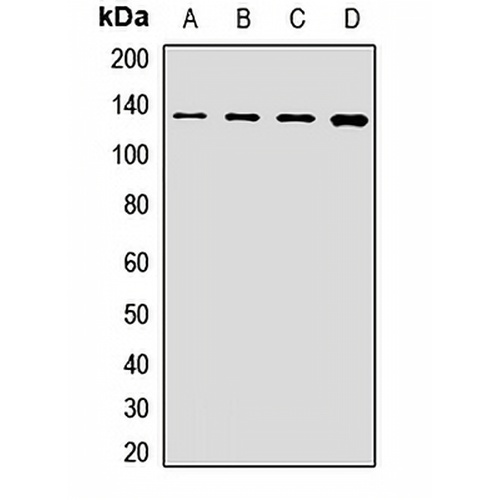 POLR2B Rabbit Polyclonal Antibody