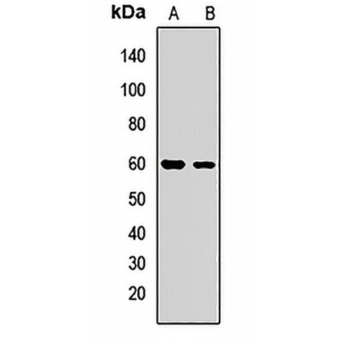 MetaP2 Rabbit Polyclonal Antibody