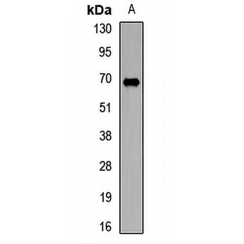 TRMT2A Rabbit Polyclonal Antibody