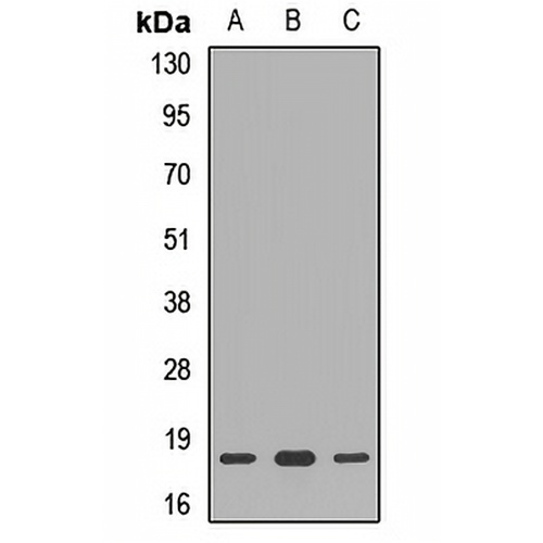RPS10 Rabbit Polyclonal Antibody