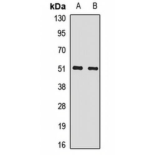 SNRNP70 Rabbit Polyclonal Antibody