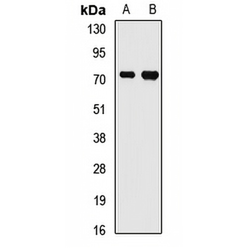 FMR1 Rabbit Polyclonal Antibody