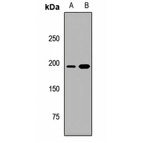 RICTOR Rabbit Polyclonal Antibody