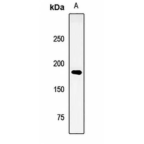 LRP6 Rabbit Polyclonal Antibody