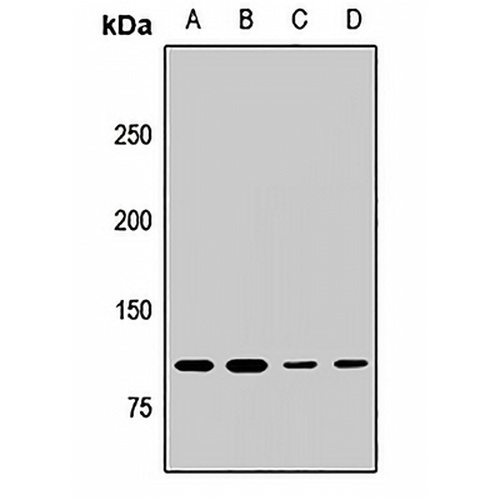 MLL5 Rabbit Polyclonal Antibody