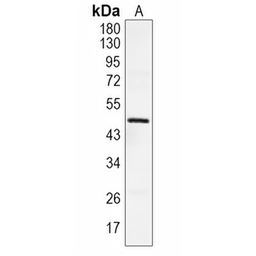 SMYD5 Rabbit Polyclonal Antibody
