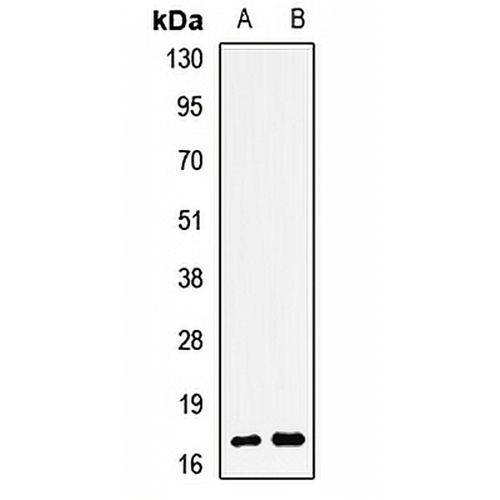 TSSC3 Rabbit Polyclonal Antibody