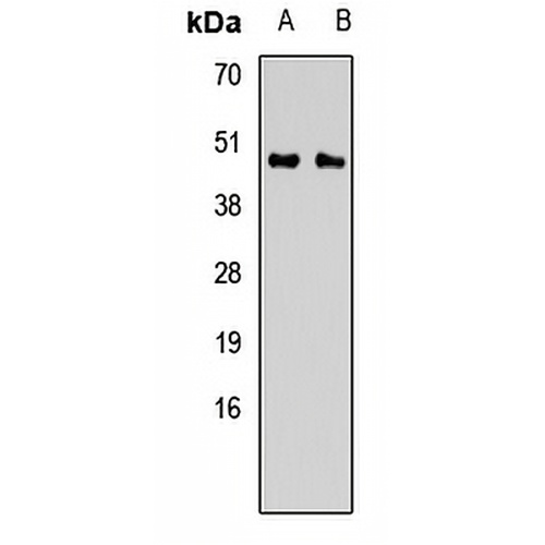 CALU Rabbit Polyclonal Antibody