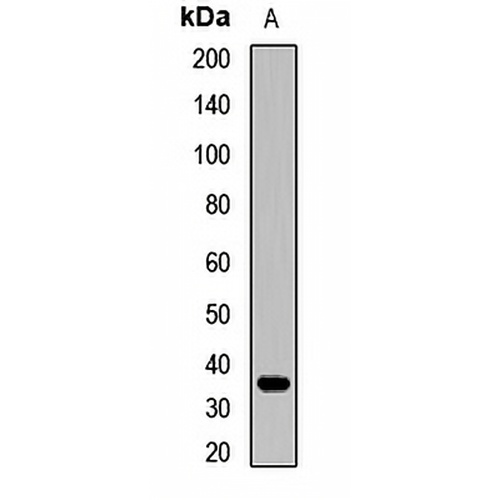 CRHBP Rabbit Polyclonal Antibody