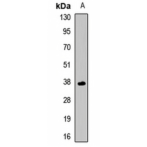 LECT1 Rabbit Polyclonal Antibody