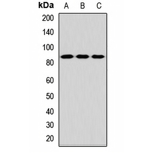 TLK2 Rabbit Polyclonal Antibody