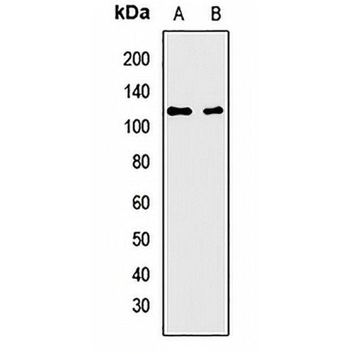 AIP2 Rabbit Polyclonal Antibody